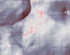 romso groups